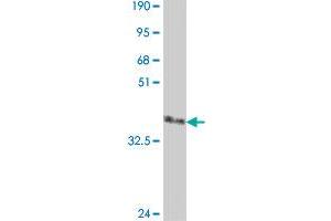 Western Blot detection against Immunogen (37. (DIRAS2 antibody  (AA 81-180))