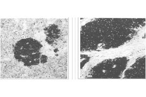 Left and Center: Immunohistochemical staining of normal pancreas tissue (left) and small bowel tumor tissue (center) using NSE antibody (X2070M and X2071M). (ENO2/NSE antibody)