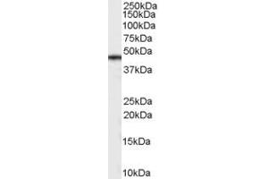 ABIN185622 (0. (Casein Kinase 1 delta antibody  (Internal Region))