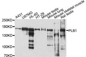 Western blot analysis of extracts of various cell lines, using PLB1 antibody. (Phospholipase B antibody  (AA 1110-1415))