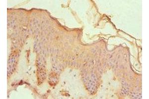 Immunohistochemistry of paraffin-embedded human skin tissue using ABIN7148815 at dilution of 1:100 (CREB3 antibody  (AA 1-230))