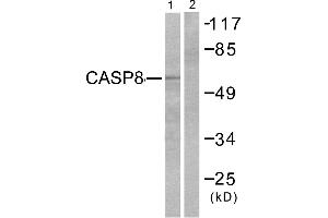 Western blot analysis of extracts from NIH/3T3 cells treated with TNF-α(20ng/ml,30min), using Caspase 8 (Ab-347) antibody (#B0059, Line 1 and 2). (Caspase 8 antibody  (Ser347))