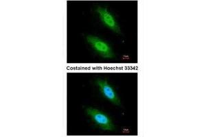 ICC/IF Image Immunofluorescence analysis of paraformaldehyde-fixed HeLa, using CARD8, antibody at 1:200 dilution. (CARD8 antibody  (C-Term))