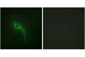 Immunofluorescence analysis of HeLa cells, using Collagen V alpha1 Antibody. (COL5A1 antibody  (AA 301-350))