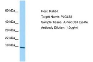 Image no. 1 for anti-Plasminogen-Like B2 (PLGLB2) (AA 38-87) antibody (ABIN6750018)