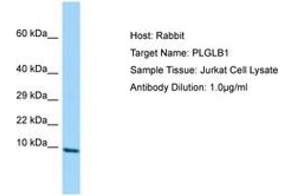 PLGLB2 Antikörper  (AA 38-87)