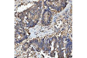 IHC analysis of PRMT5 using anti-PRMT5 antibody (ABIN7600176).