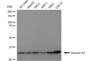 Western blotting analysis using Annexin A2 antibody (ABIN7797617).