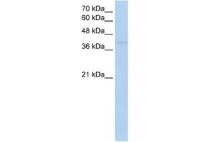 RNF165 antibody used at 1 ug/ml to detect target protein. (RNF165 antibody  (Middle Region))