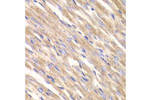 Immunohistochemistry of paraffin-embedded rat heart using SLC25A4 antibody at dilution of 1:100 (400x lens).