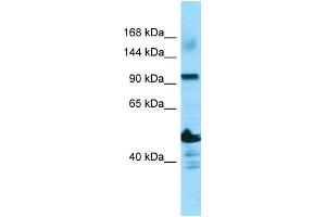 WB Suggested Anti-ADAMTS14 Antibody Titration: 1.