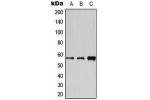 Western blot analysis of Cytochrome P450 2A6 expression in HeLa (A), Jurkat (B), MCF7 (C) whole cell lysates.
