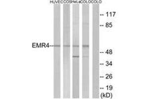 Western blot analysis of extracts from HuvEc cells/COS7 cells/HeLa cells/COLO205 cells, using EMR4 Antibody. (EMR4 antibody  (AA 101-150))