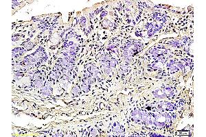 Formalin-fixed and paraffin embedded rat colitis tissue labeled with Rabbit Anti-Podoplanin/gp36 Polyclonal Antibody (ABIN736896), Unconjugated 1:200 followed by conjugation to the secondary antibody and DAB staining (Podoplanin antibody  (AA 91-166))