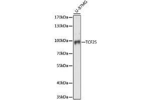 Western blot analysis of extracts of U-87MG cells, using TCF25 antibody (ABIN6293615) at 1:1000 dilution.