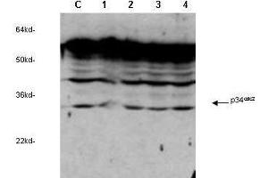 anti-cdc2 Cyclin Dependent Kinase  was used to detect human p34cdc2by western blot in untreated (Contol) and drug treated lysates of MCF-7 cells. (CDK5 antibody)