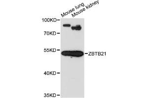 Western blot analysis of extracts of various cell lines, using ZBTB21 antibody (ABIN6291079) at 1:3000 dilution. (ZNF295 antibody)