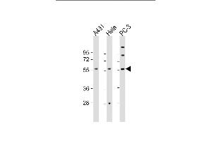 All lanes : Anti-CCT8L2 Antibody (C-Term) at 1:2000 dilution Lane 1: A431 whole cell lysate Lane 2: Hela whole cell lysate Lane 3: PC-3 whole cell lysate Lysates/proteins at 20 μg per lane. (CCT8L2 antibody  (AA 511-542))