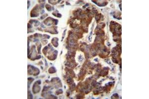 Formalin fixed and paraffin embedded human pancreas tissue reacted with Dermatopontin Antibody (N-term) followed by peroxidase conjugation of the secondary antibody and DAB staining. (Dermatopontin antibody  (N-Term))