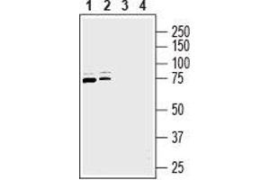 Western blot analysis of rat brain membranes (lanes 1 and 3) and new born rat brain membranes (lanes 2 and 4): - 1,2. (SLC9A6 antibody  (C-Term, Intracellular))