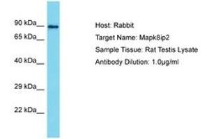 Image no. 1 for anti-C-Jun-Amino-Terminal Kinase-Interacting Protein 2 (JIP-2) (AA 307-356) antibody (ABIN6750348) (IB2 antibody  (AA 307-356))