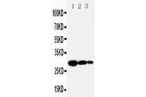 Anti-TIMP1 antibody, Western blotting Lane 1: Recombinant Human TIMP-1 Protein 10ng Lane 2: Recombinant Human TIMP-1 Protein 5ng Lane 3: Recombinant Human TIMP-1 Protein 2. (TIMP1 antibody  (C-Term))