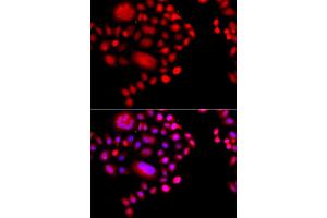 Immunofluorescence analysis of A549 cell using POLR1D antibody. (POLR1D antibody)