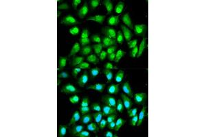 Immunofluorescence analysis of HeLa cell using RAN antibody. (RAN antibody)