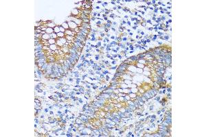 Immunohistochemistry of paraffin-embedded human appendix using  antibody (ABIN7265428) at dilution of 1:100 (40x lens). (ACOT2 antibody  (AA 222-483))