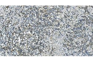 IHC analysis of CDC123 using anti-CDC123 antibody (ABIN7599284). (CDC123 antibody  (AA 1-336))