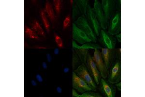 ABIN6259993 and ABIN6278082 staining  cells by IF/ICC. (Apolipoprotein D antibody  (Internal Region))