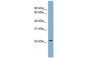 WB Suggested Anti-CCDC25 Antibody Titration: 0. (CCDC25 antibody  (Middle Region))
