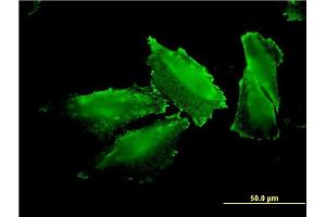 Immunofluorescence of monoclonal antibody to MARS on HepG2 cell. (Mars (MARS) (AA 801-899) antibody)