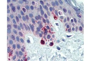 TYRP1 antibody was used for immunohistochemistry at a concentration of 4-8 ug/ml. (Tyrosinase-Related Protein 1 antibody  (Middle Region))