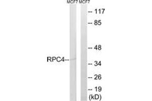 Western blot analysis of extracts from MCF-7 cells, using RPC4 Antibody. (POLR3D antibody  (AA 281-330))
