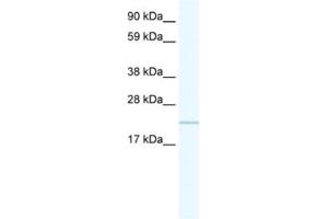 Western Blotting (WB) image for anti-Chromosome 16 Open Reading Frame 80 (C16orf80) antibody (ABIN2460910) (C16orf80 antibody)