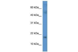 Western Blot showing CGB antibody used at a concentration of 1. (CGB antibody  (C-Term))