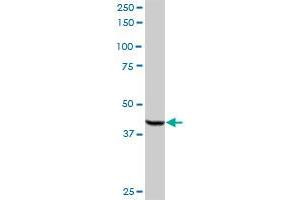 ACOX2 MaxPab rabbit polyclonal antibody. (Acox2 antibody  (AA 1-681))