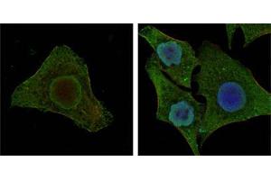 Confocal immunofluorescence analysis of MCF-7 (left) and HepG2 (right) cells using BRAF mouse mAb (green). (BRAF antibody)