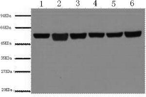 Western Blotting (WB) image for anti-Tubulin, beta (TUBB) antibody (ABIN6566394) (TUBB antibody)