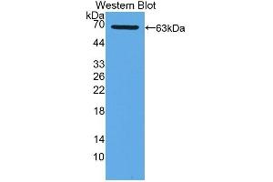 Detection of Recombinant XDH, Human using Polyclonal Antibody to Xanthine Dehydrogenase (XDH) (XDH antibody  (AA 1-300))