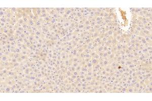 Detection of C3a in Mouse Liver Tissue using Polyclonal Antibody to Complement Component 3a (C3a) (C3a antibody  (AA 671-748))