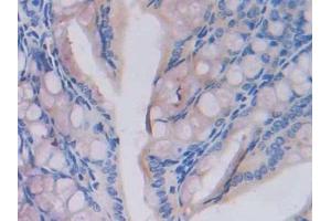 Used in DAB staining on fromalin fixed paraffin- embedded testis tissue (Fatty Acid Synthase antibody  (AA 2257-2504))