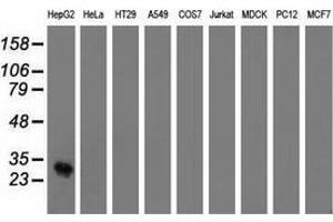 Western blot analysis of extracts (35 µg) from 9 different cell lines by using anti-OTUB2 monoclonal antibody. (OTUB2 antibody)