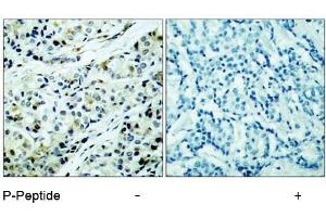 Image no. 1 for anti-Histone Deacetylase 5 (HDAC5) (pSer498) antibody (ABIN196932) (HDAC5 antibody  (pSer498))