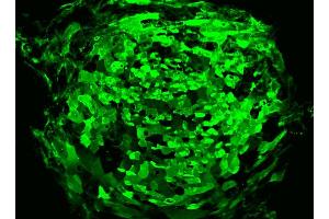 Immunofluorescent staining of human ES cell line. (TRA1-81 antibody)