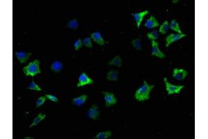 Immunofluorescence staining of SH-SY5Y cells with ABIN7139719 at 1:100, counter-stained with DAPI. (SNCA antibody  (AA 119-136))