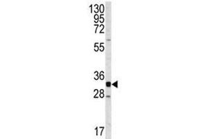 Western Blotting (WB) image for anti-Cyclin-Dependent Kinase 2 (CDK2) (AA 230-260) antibody (ABIN3030609)