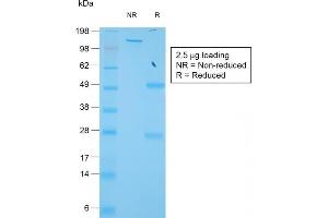 SDS-PAGE Analysis of Purified TIMP1 Rabbit Recombinant Monoclonal Antibody (TIMP1/1944R).