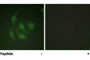 Immunofluorescence analysis of HepG2 cells, using CAMK4 polyclonal antibody .